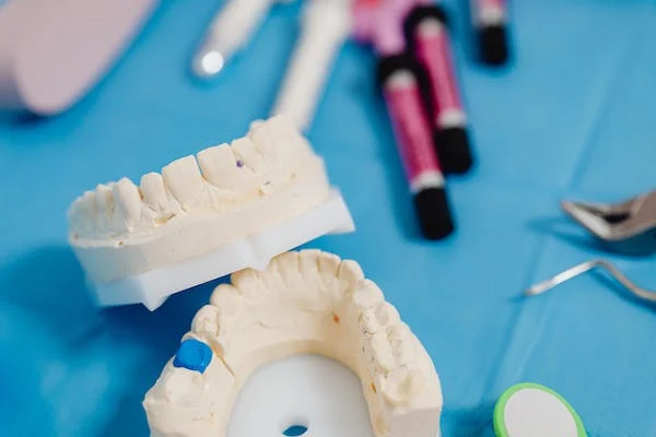 implant-dentaire implant-dentaire